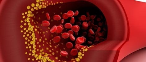 Estrógenos frente aterosclerosis
