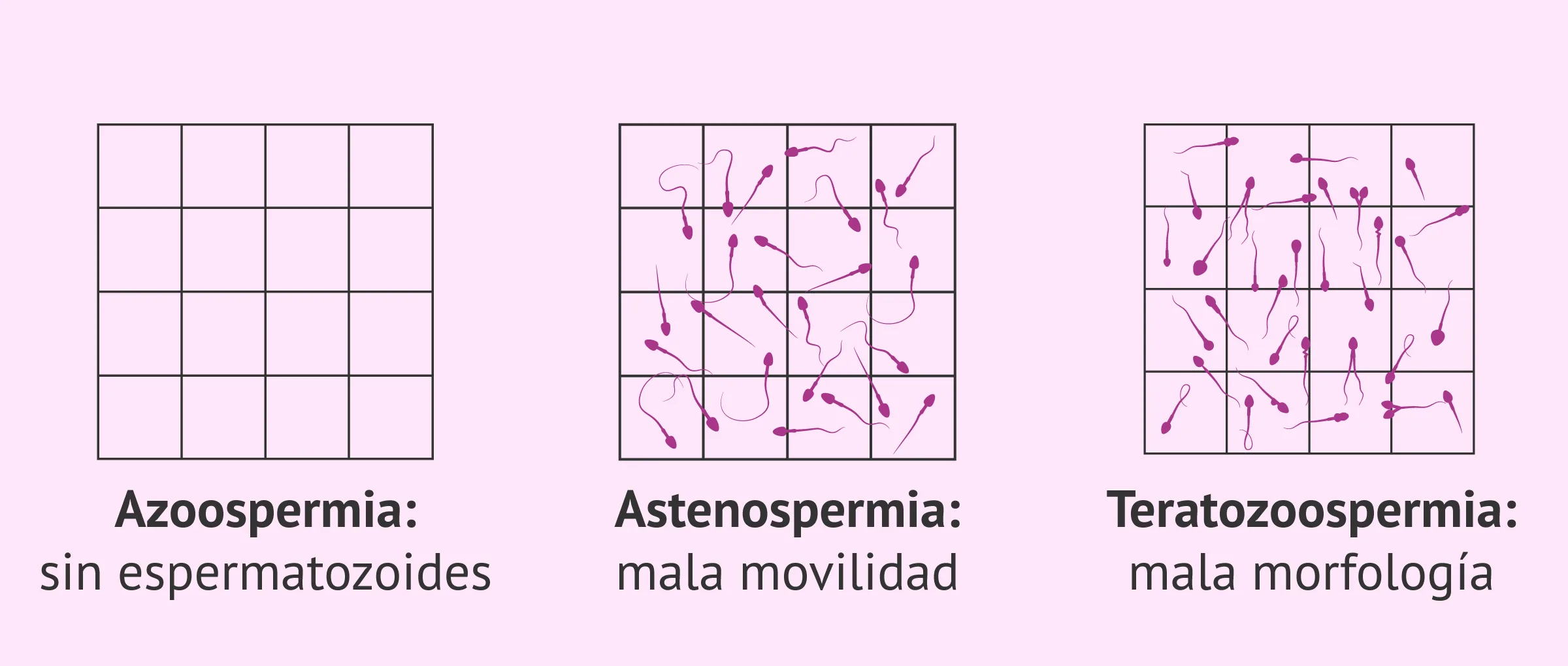 Factor espermático