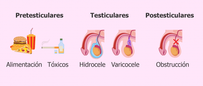 Imagen: Causas que provocan oligospermia en el varón