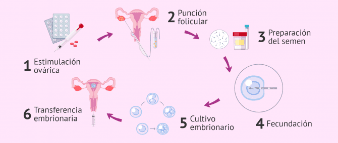 Imagen: ¿Cómo es todo el proceso de FIV?