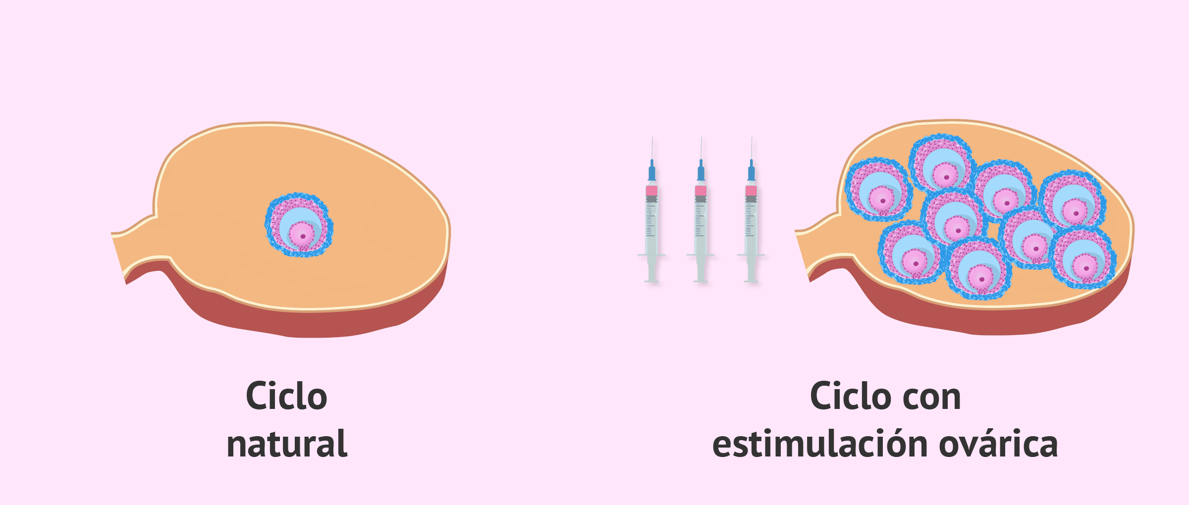 Imagen: Ciclo normal vs. ciclo estimulado