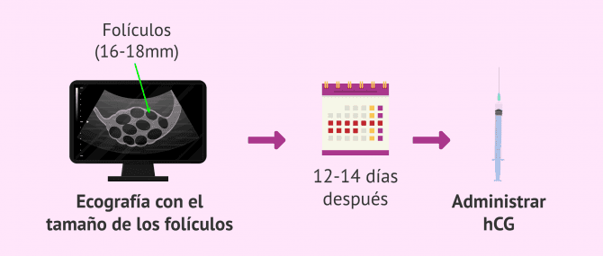 Imagen: Control ecográfico y administración de hCG