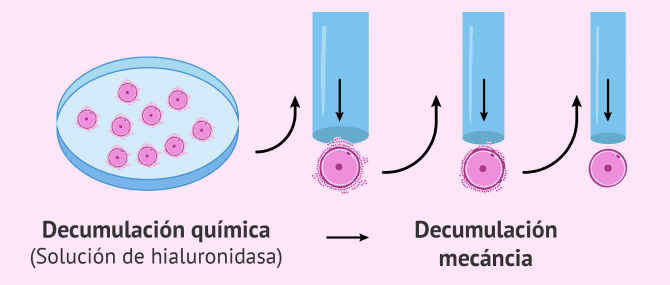Imagen: Decumulación de óvulos