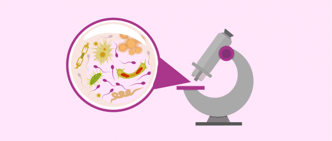 Imagen: Cultivo de semen en el diagnóstico de la prostatitis