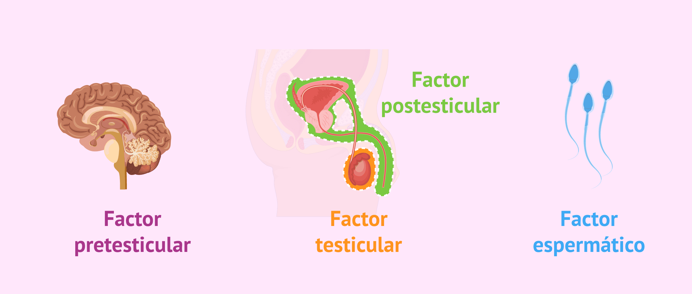 ¿Cuáles son las enfermedades que causan esterilidad masculina?