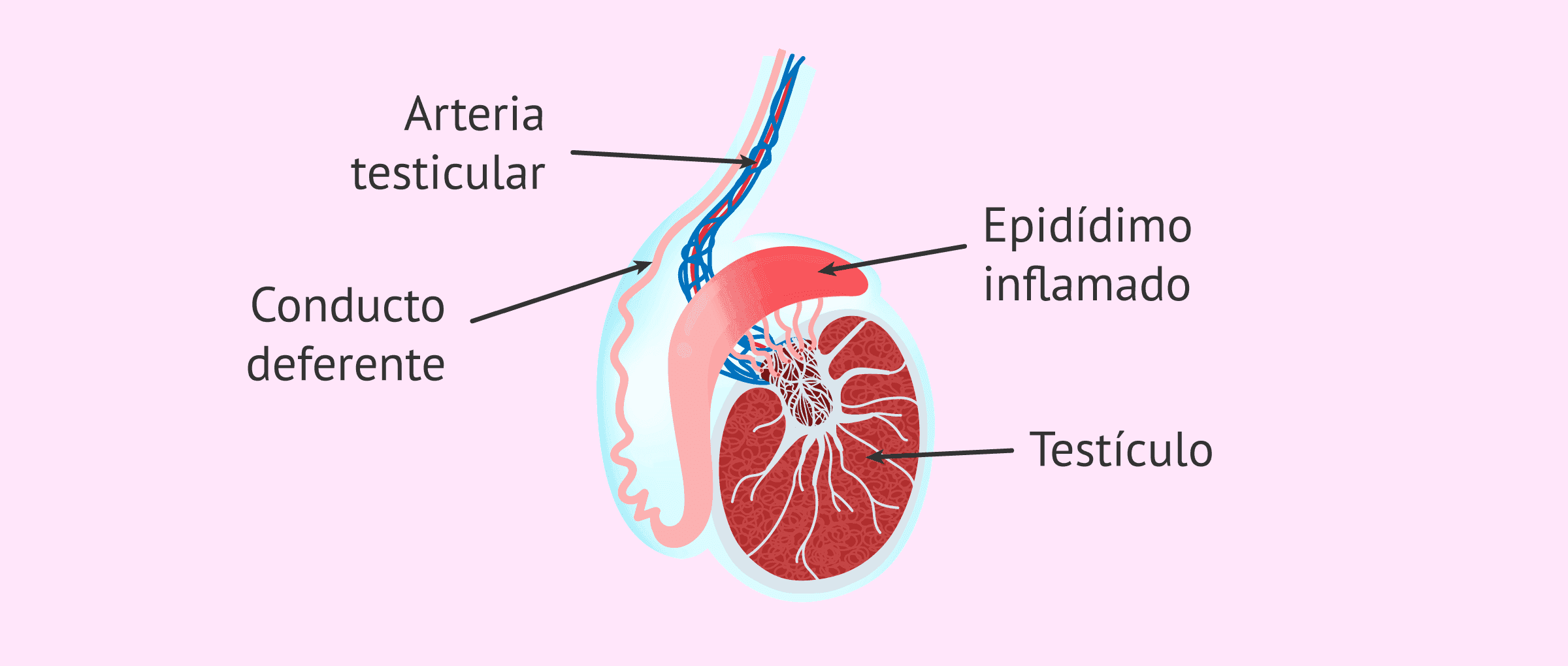 ¿Qué es la epididimitis? Causas, síntomas y tratamientos