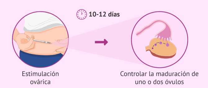 Imagen: Estimulación ovárica para controlar la maduración de los óvulos