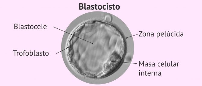 Imagen: Blastocisto