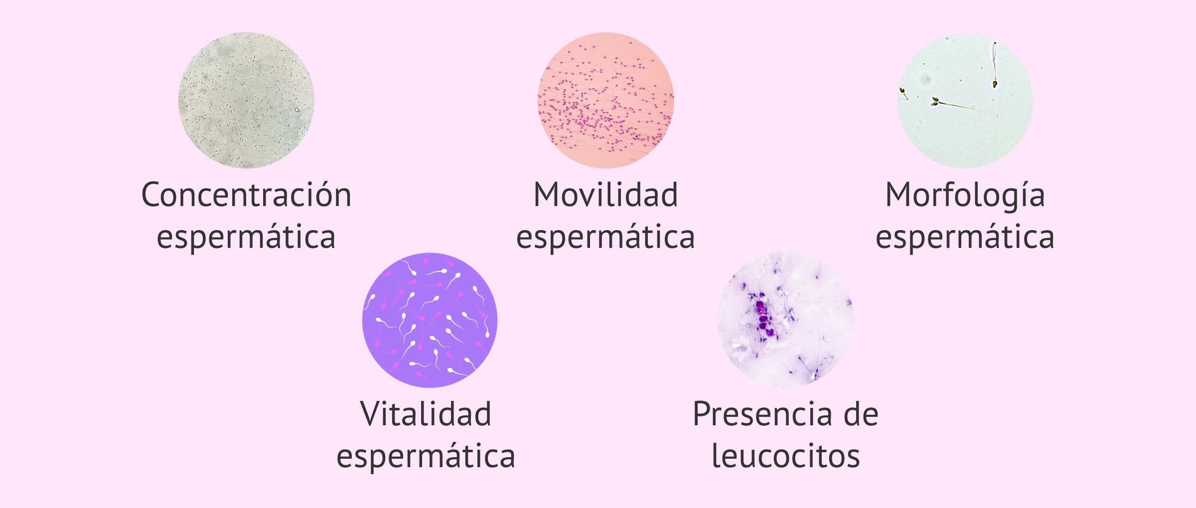 Imagen: Parámetros microscópicos del análisis del semen