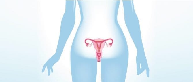Imagen: Extirpar el ovario