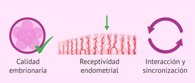 Imagen: Elementos involucrados en la implantación