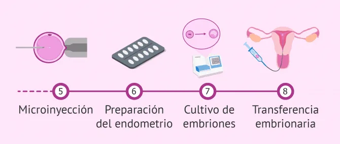 Imagen: Etapas de la ICSI