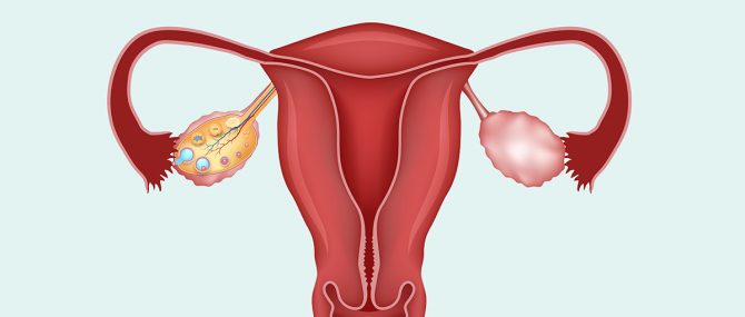 Imagen: Nacimiento tras un transplante completo del ovario