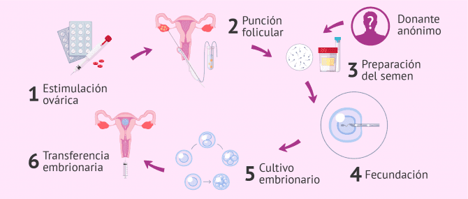 Imagen: FIV para mujeres solteras