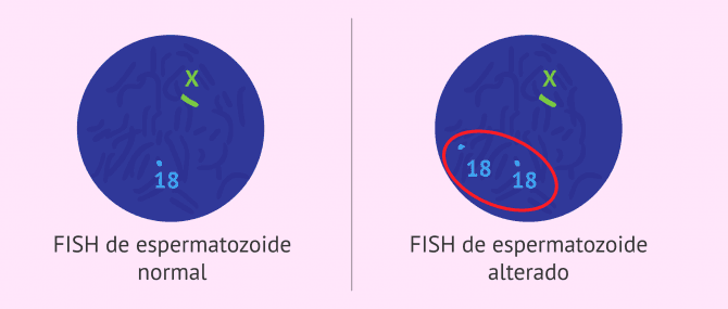 Imagen: FISH de espermatozoides