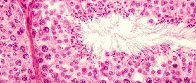 Imagen: Formación de espermatozoides