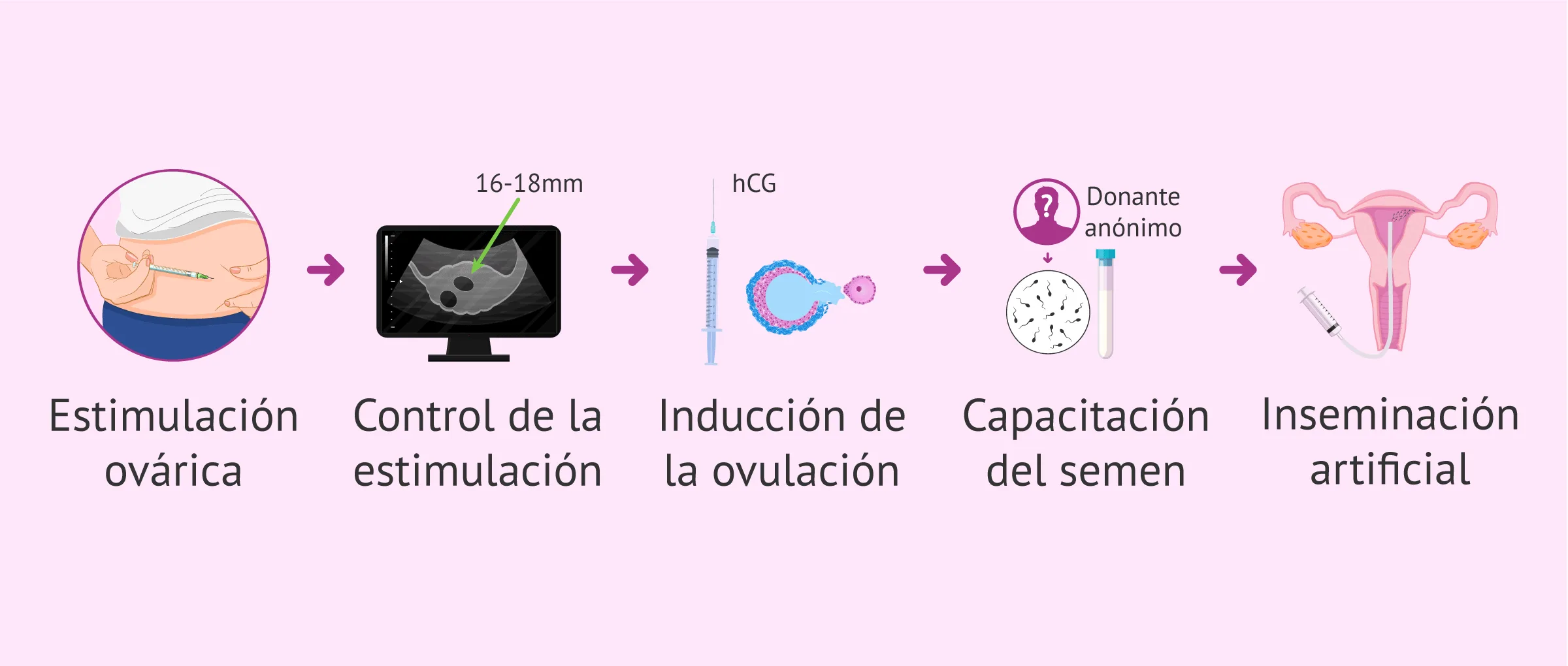 Tratamientos para ser madre soltera