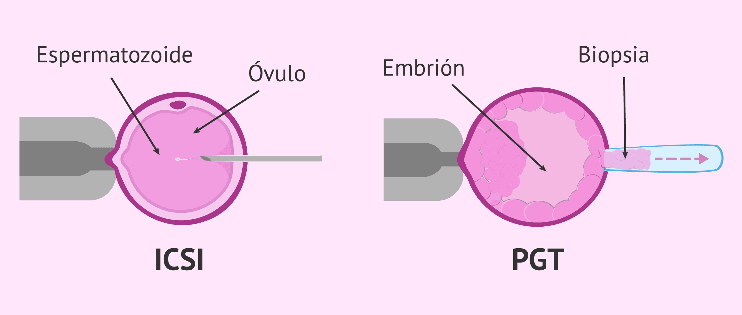 Imagen: Técnicas complementarias en FIV