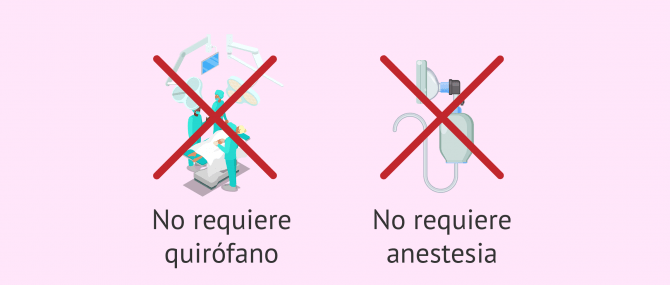 Imagen: Técnica de inseminación artificial
