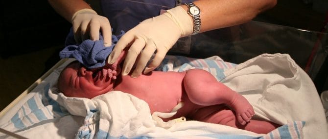 Imagen: La cesárea solo se debe programar en aquellos casos en que sea estrictamente necesario