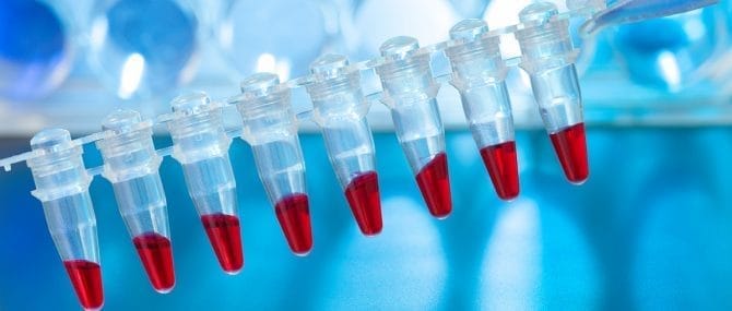 Imagen: Ayudas para la investigación 