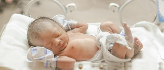 Imagen: Los partos prematuros en el mundo