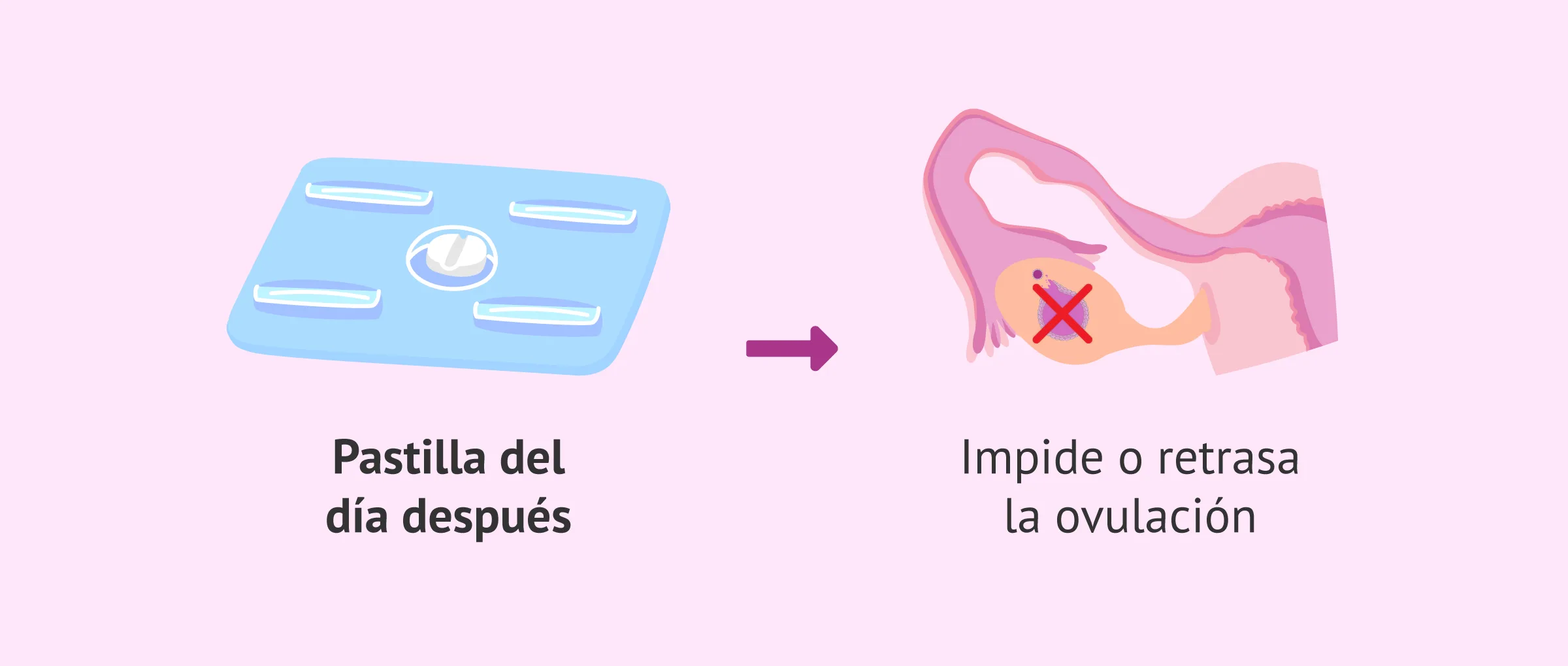 Imagen: Momento en el que utilizar la postday