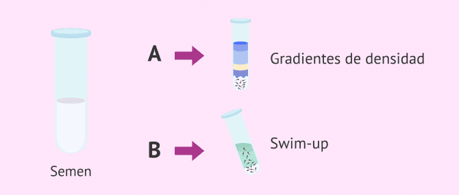 Imagen: Métodos de capacitación espermática