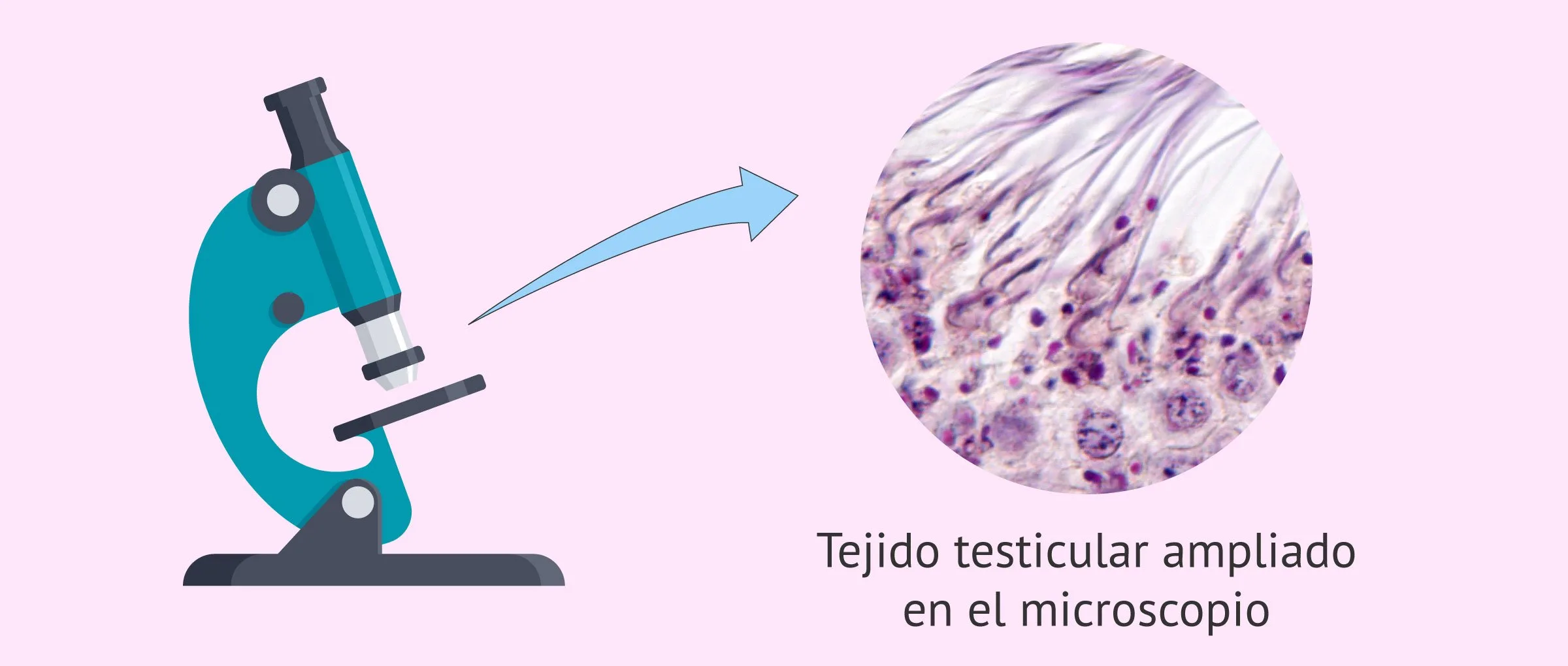 Tumor Inguinal En Hombres: Síntomas, Diagnóstico Y Tratamiento. Microscopio Tejido Testicular.jpg Imagen: Observación Del Tejido Testicular Al Microscopio