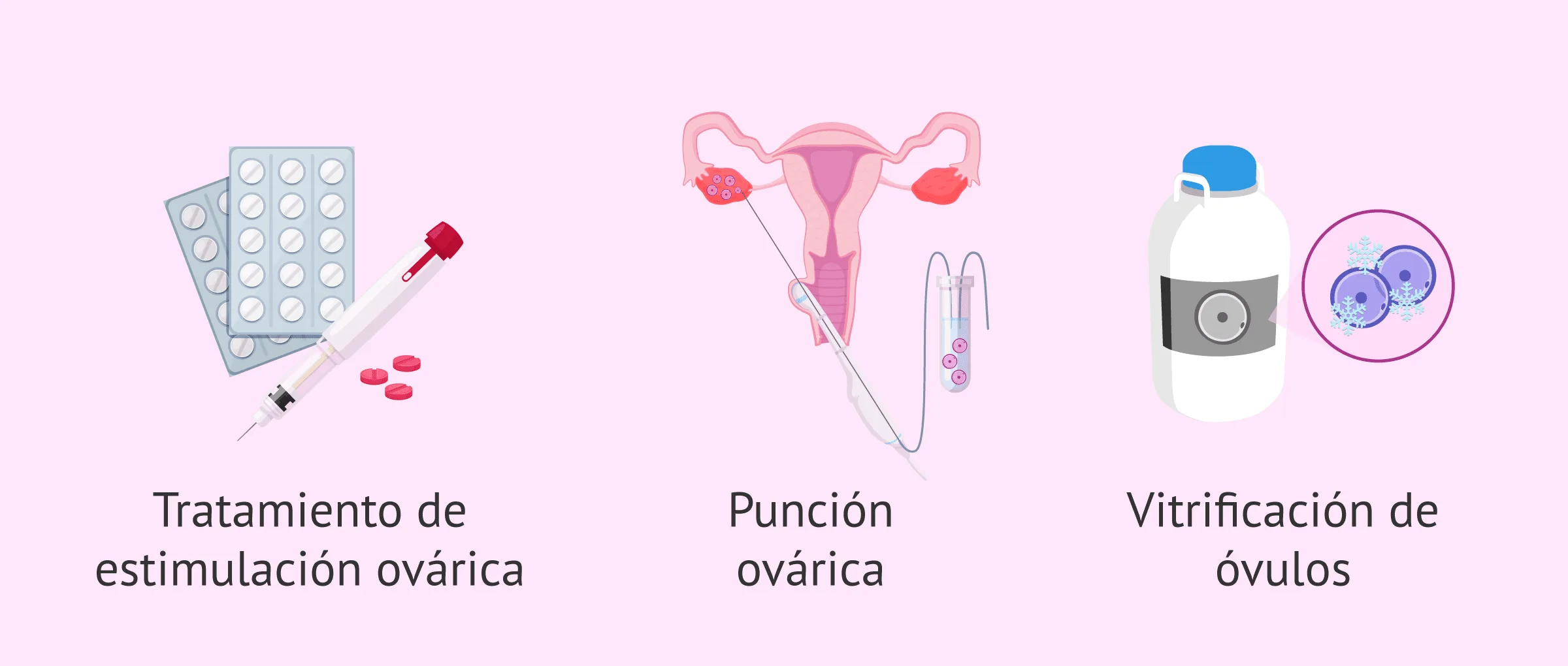 Pasos para congelar óvulos