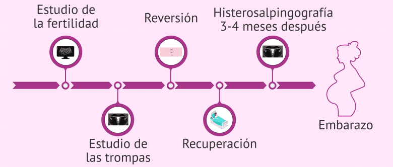 Imagen: Proceso del tratamiento reversión de la ligadura de trompas