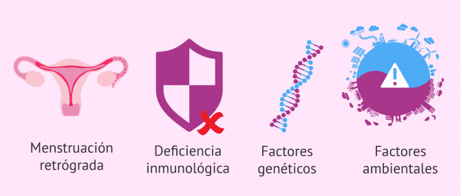 Imagen: Posibles explicaciones de la endometriosis