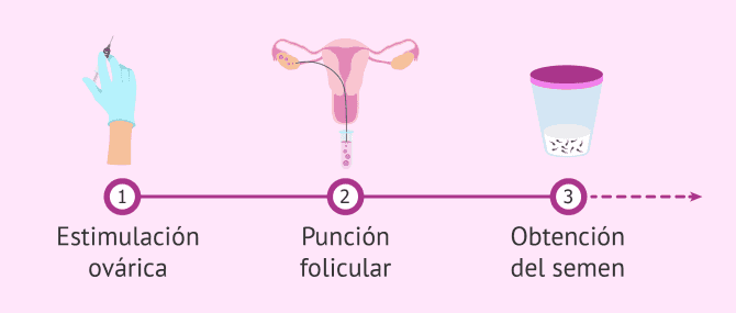 Imagen: Primeros pasos en un ciclo de FIV