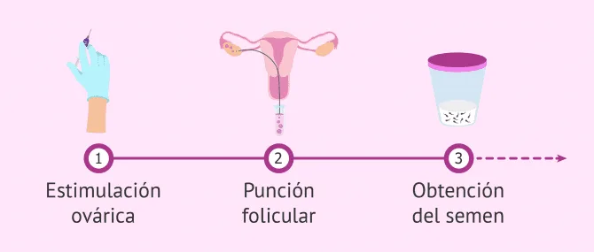 Imagen: Primeros pasos en un ciclo de FIV