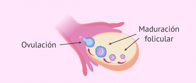 Imagen: Esterilidad en la mujer por alteraciones hormonales