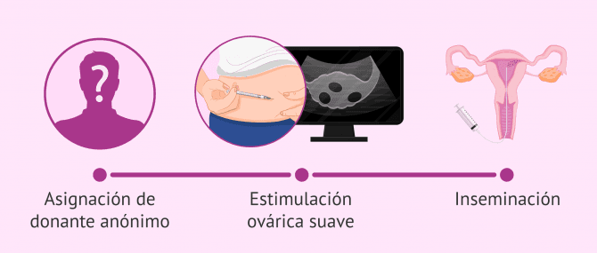 Imagen: Proceso de la IAD para mujeres homosexuales