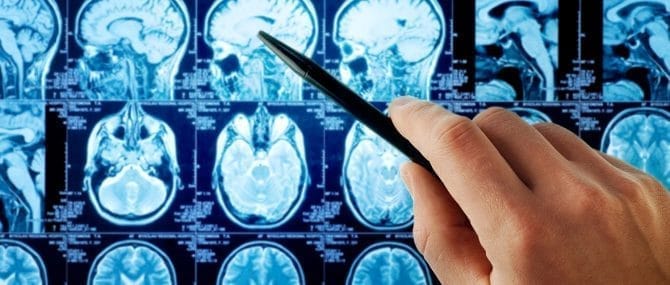 Imagen: Desarrollar un tumor