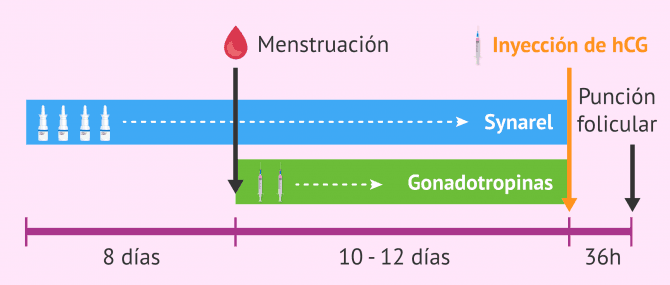 Imagen: Protocolo largo de estimulación ovárica con Synarel