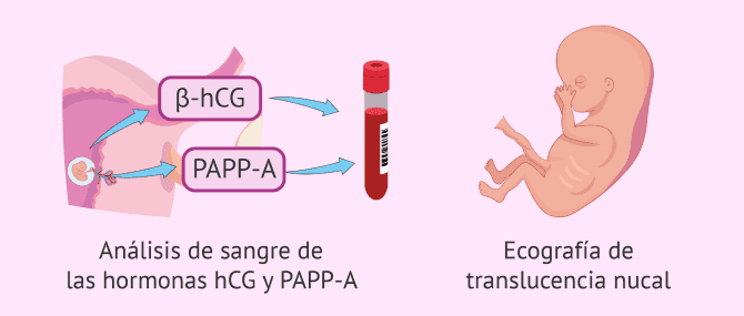 Imagen: Prueba del triple screening