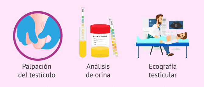 Imagen: Buscar glóbulos blancos en el semen