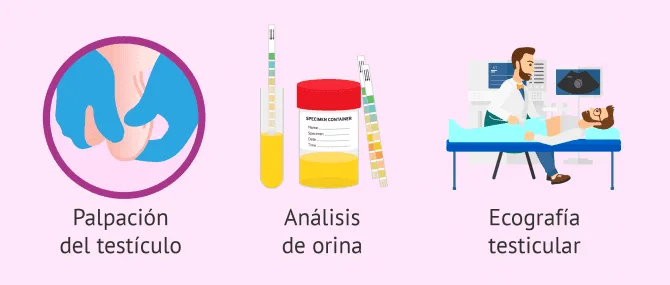 Imagen: Buscar glóbulos blancos en el semen