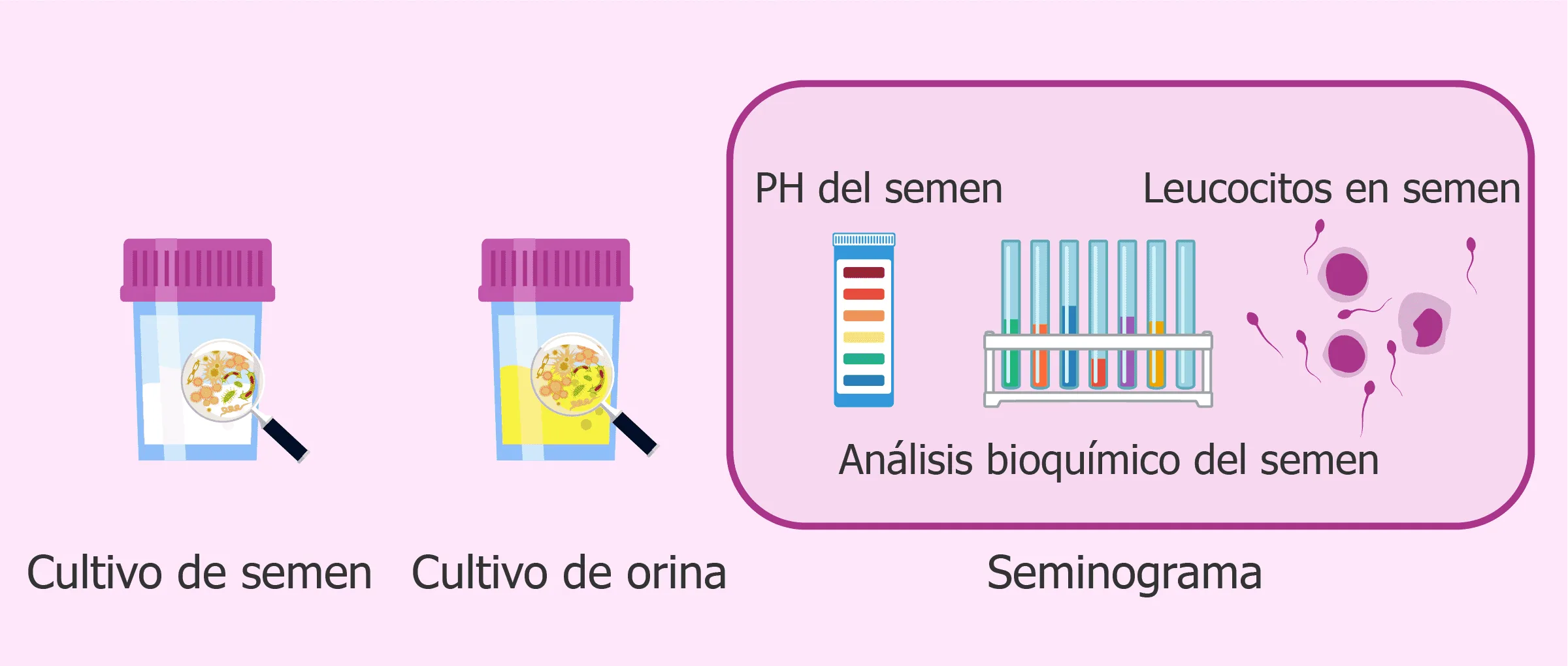 Infecciones en el semen