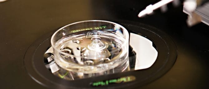 Imagen: RA en números