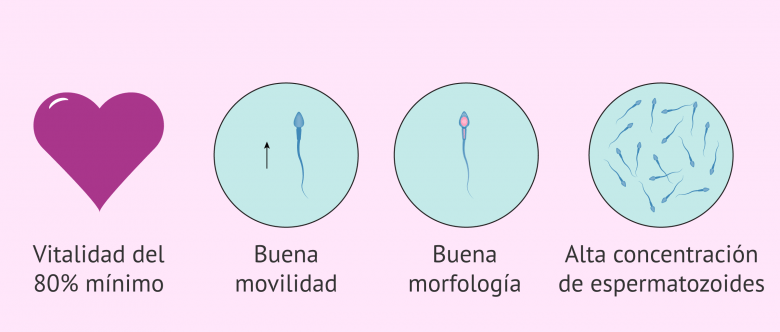 Imagen: Espermatozoides en el eyaculado