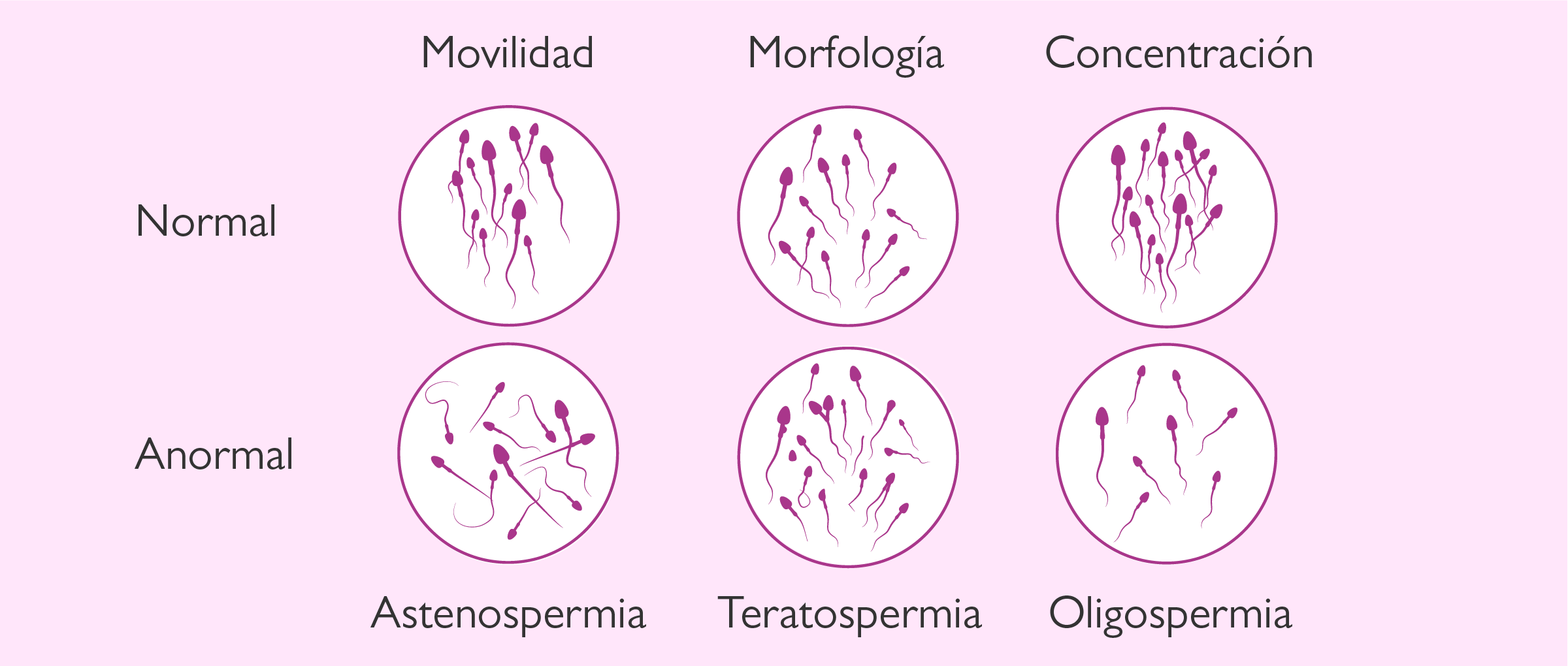 Resultados Del Seminograma Resultados Del Seminograma