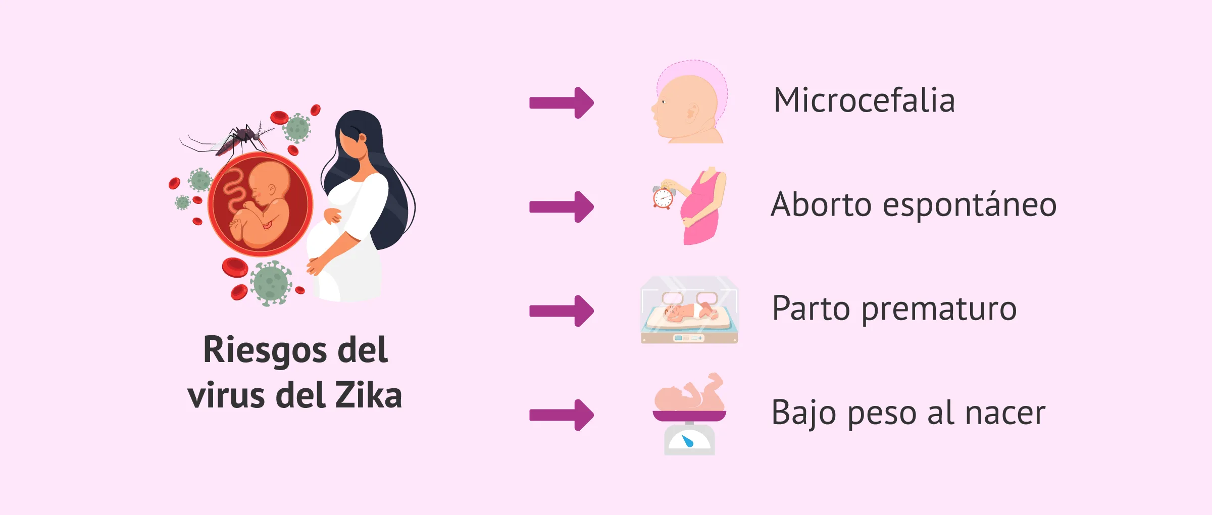 Imagen: Efectos del Zika en el recién nacido