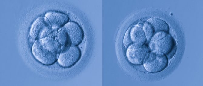 Imagen: El embrión óptimo para la transferencia al útero en fecundación in vitro