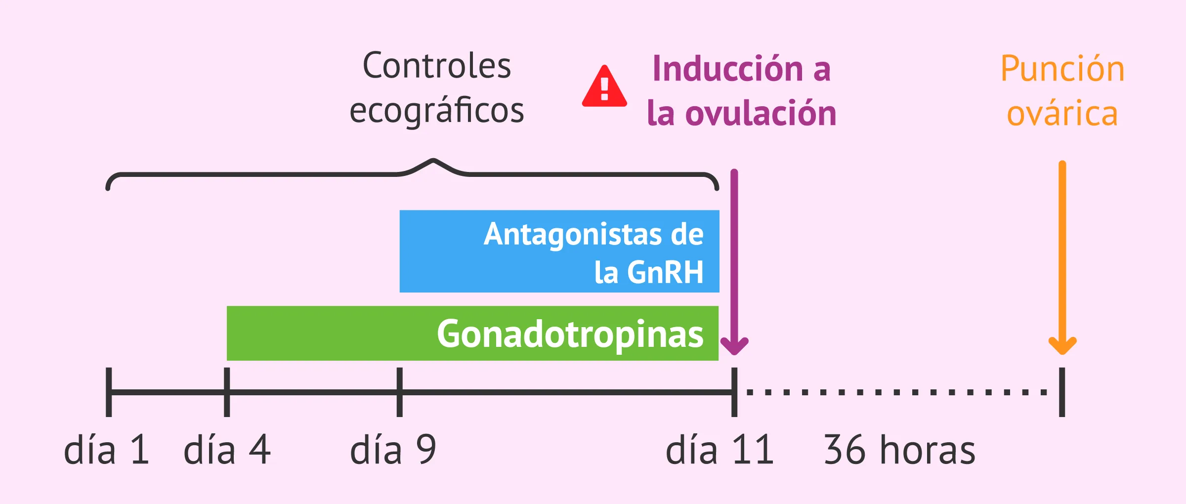 Problemas en la administración del "trigger" en la estimulación ovárica
