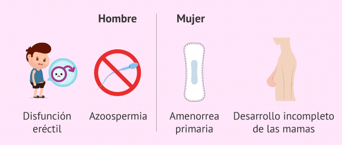 Imagen: Síntomas del síndrome de Kallmann