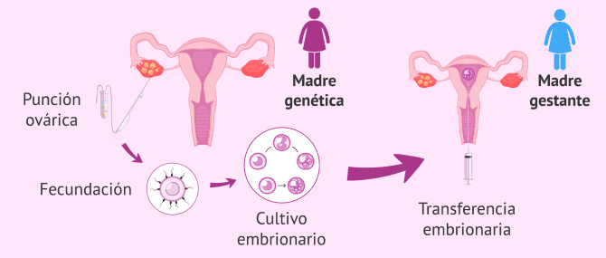 Imagen: Método ROPA